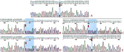 Congenital isolated adrenocorticotropic hormone deficiency in a newborn caused by TBX19 mutation: a case report and literature review